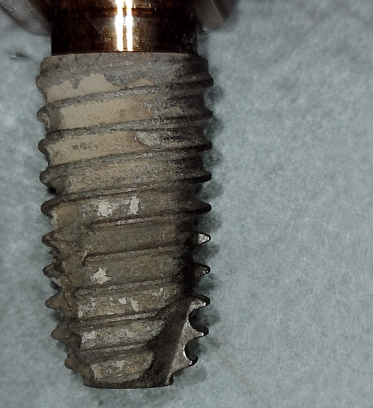 Removed implant A02 before debridement