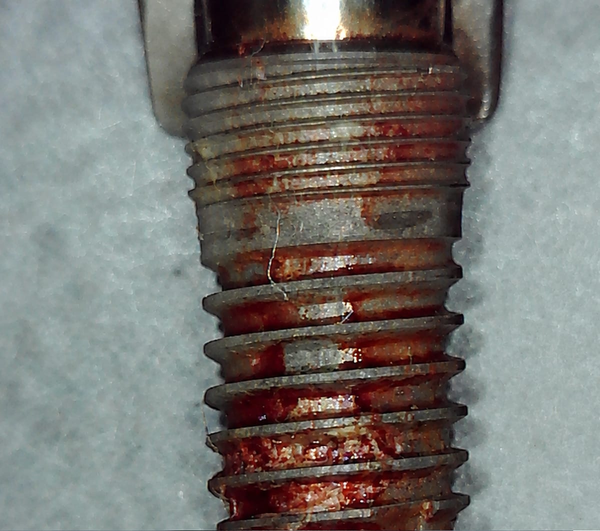 Removed implant A04 before debridement