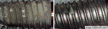 Lab test 17 — failed implant surface before and after debridement with the NiTi Brush