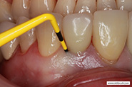 Additional pre-operative view