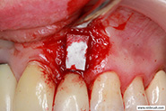 Additional post-operative view