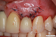 Additional post-operative view