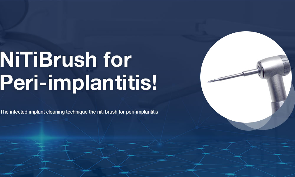 NiTiBrush for Peri-implantitis — the infected implant cleaning technique