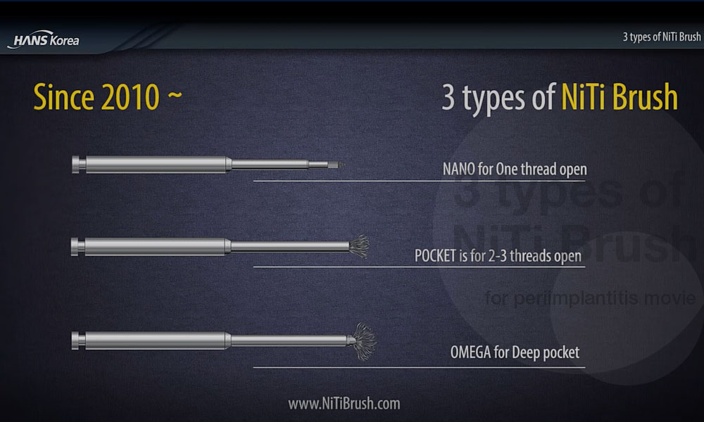 Since 2010 — types of NiTi Brush: NANO for one thread open, POCKET for 2–3 threads open, OMEGA for deep pocket